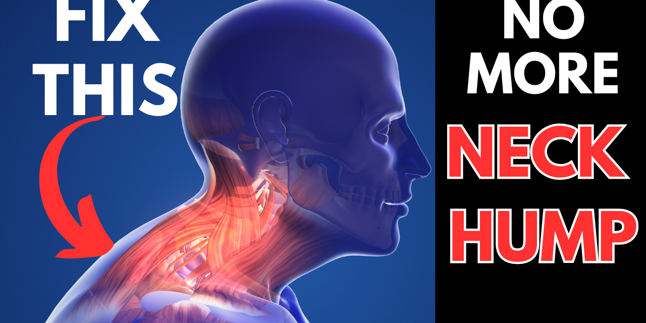 How to FIX the Hump on the Back of Your Neck